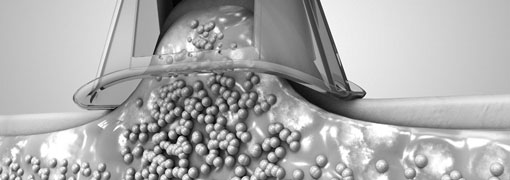 imagem em preto e branco da gordura sendo congelada durante criolipólise que pode oferecer riscos